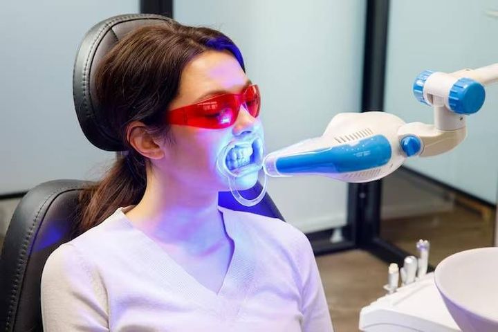 Teeth Whitening Explained: Methods, Whitening Options, Benefits, Results and Key Considerations